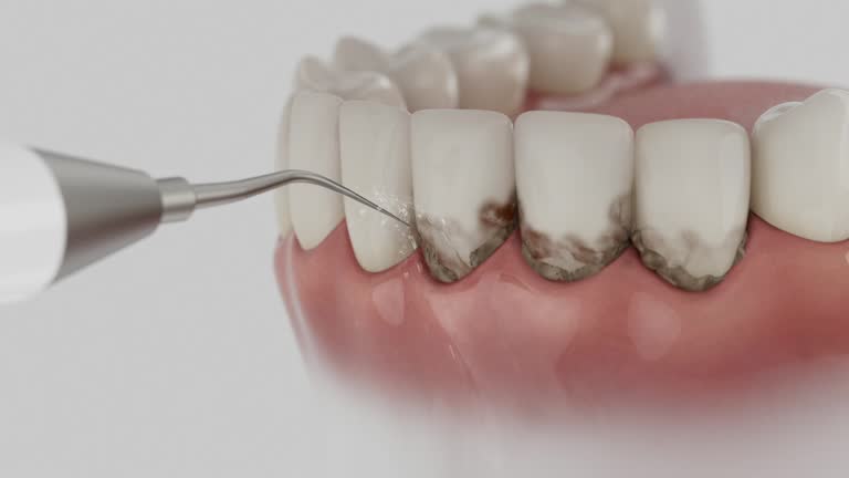 Trusted Wisdom Tooth Removal service in Franklin, GA - Dentist Open Now